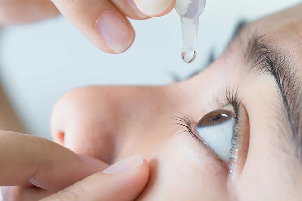 Bệnh đau mắt đỏ: Nguyên nhân, phương pháp điều trị và cách phòng ngừa
